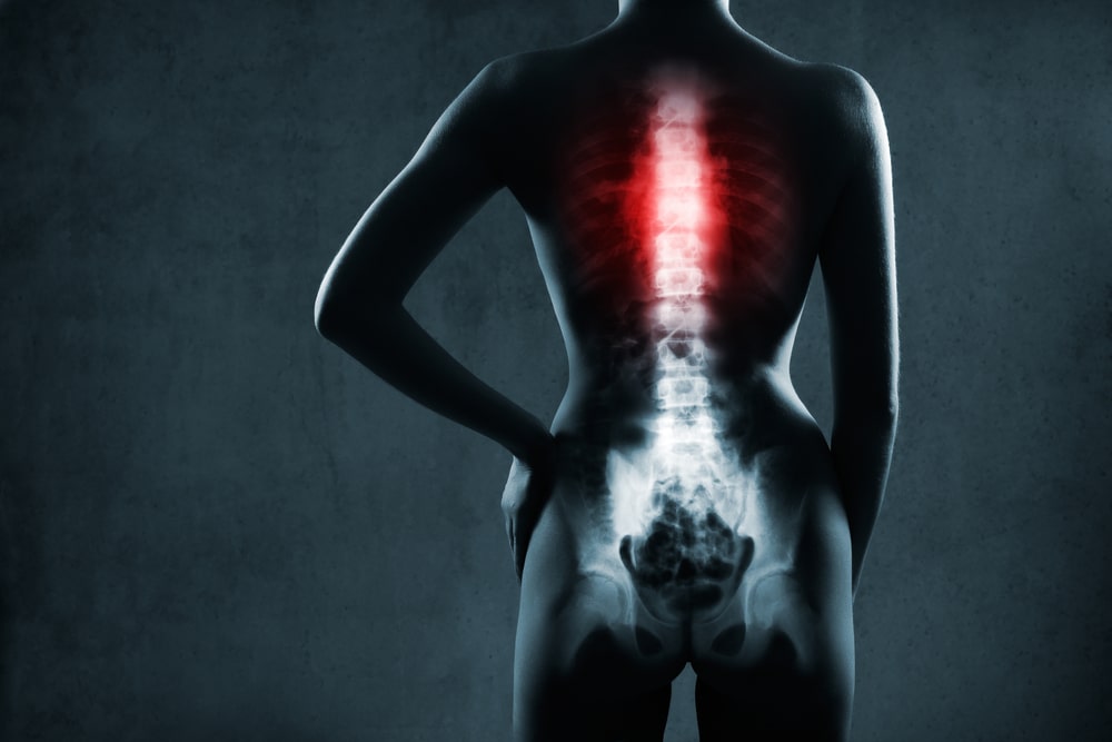spinal cord injury lawyer Indianapolis, IN
