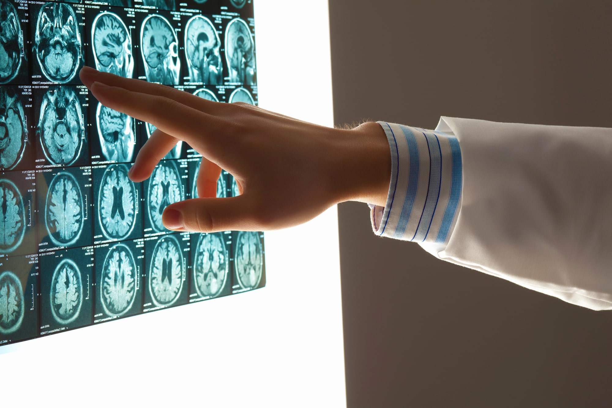 Indianapolis, IN Brain Injury Lawyer